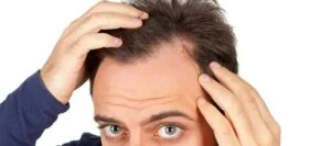 Hair Loss