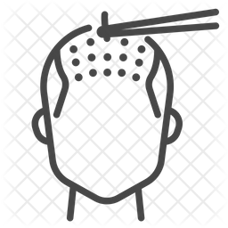 antalya saç ekim fiyatları