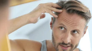 hair loss in men